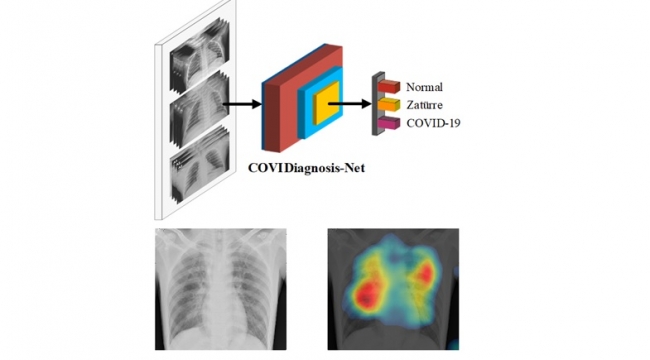 Yapay Zeka Sistemi İle Hızlı Teşhis Edilebilecek
