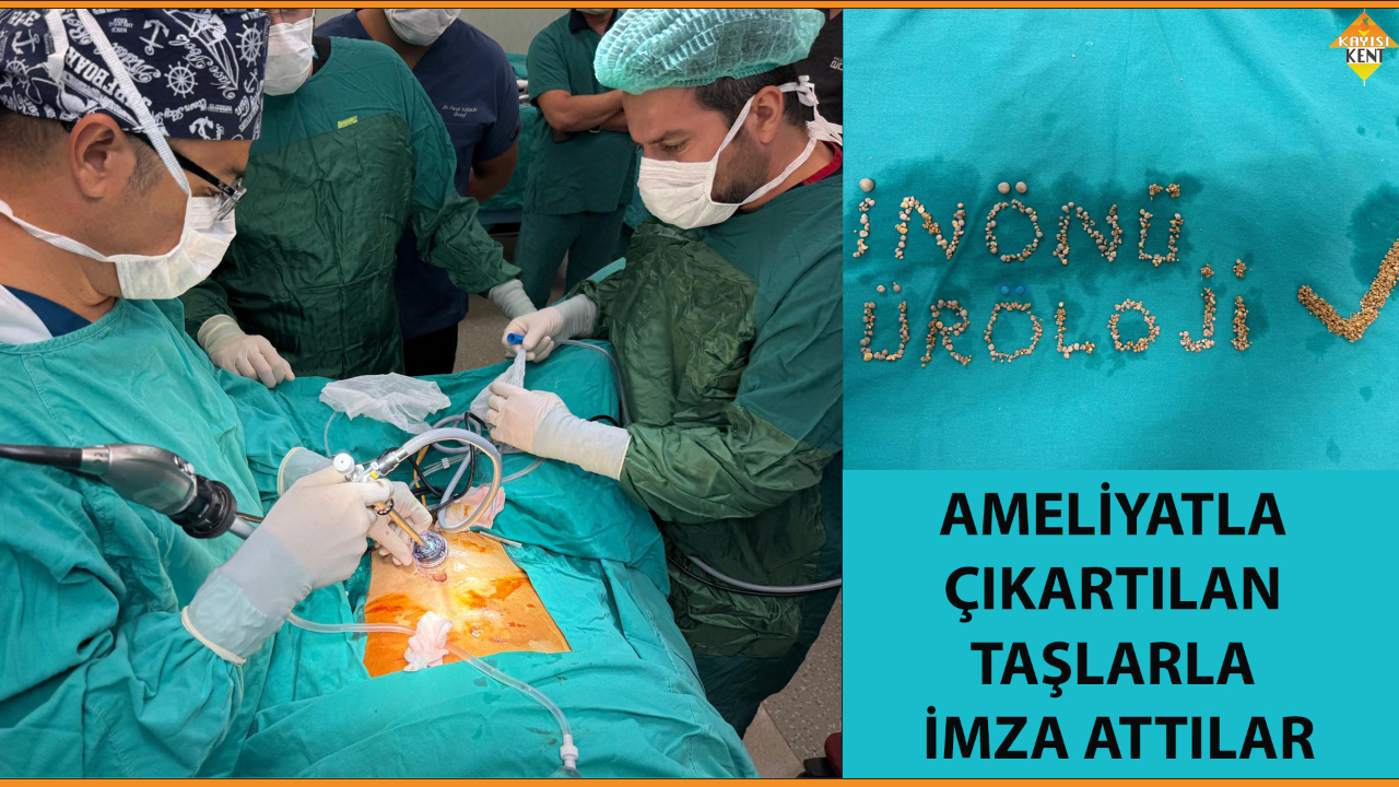 AMELİYATLA ÇIKARTILAN TAŞLARLA İMZA ATTILAR