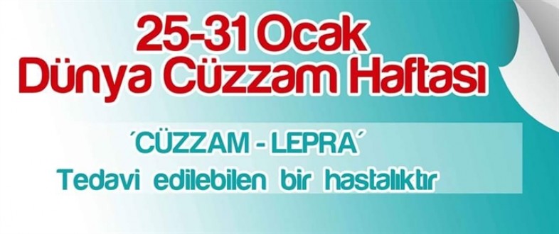 Dünya Lepra Haftası