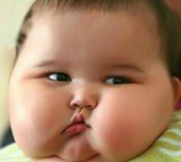 Obez Sayısı  Her Geçen Gün Artıyor