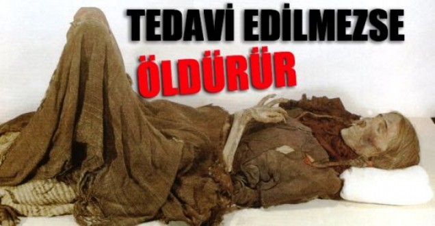 Verem Hastalığı Sağlığımzı Tehdit Ediyor