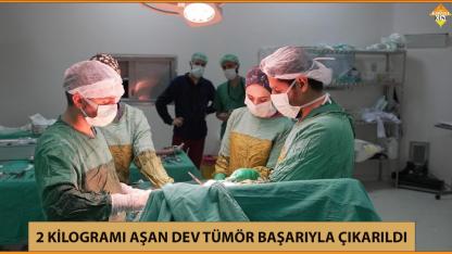 2 KİLOGRAMI AŞAN DEV TÜMÖR BAŞARIYLA ÇIKARILDI